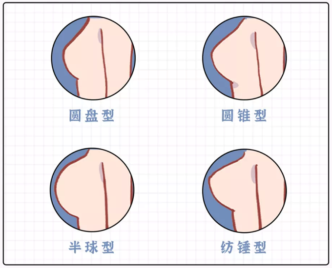 图片alt
